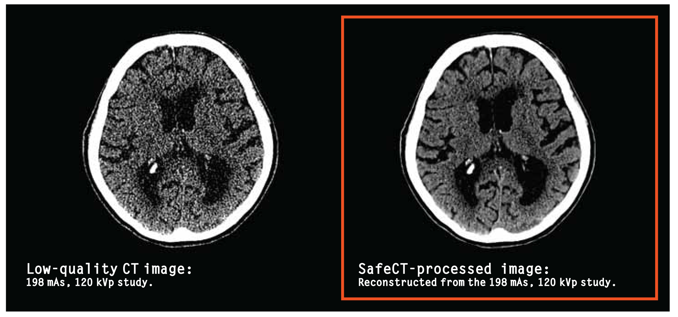 CT Dose image better