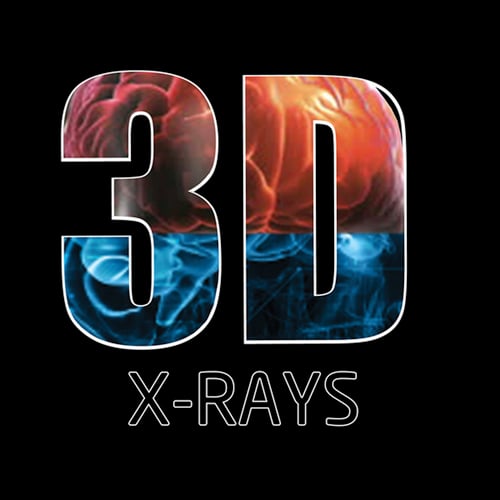 3D X-Rays