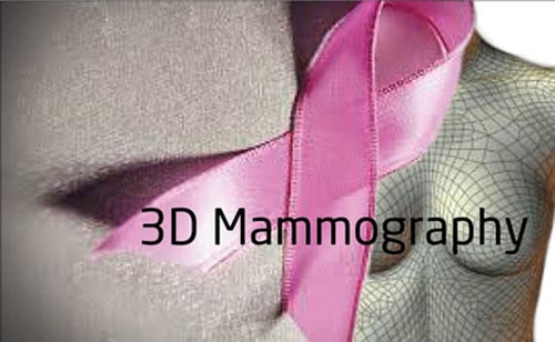 3d_blogmamo