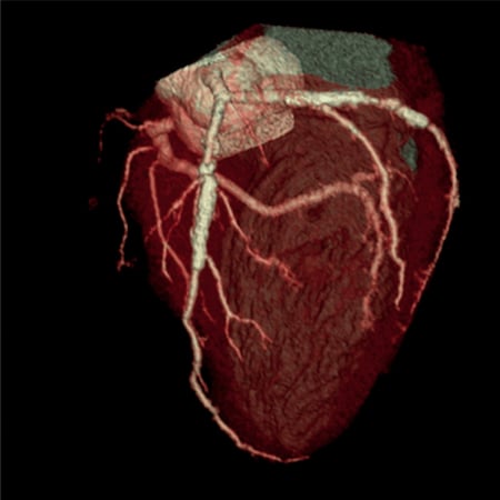 4D_Model_of_pumping_heart1