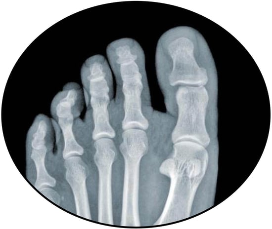 Hand X-ray
