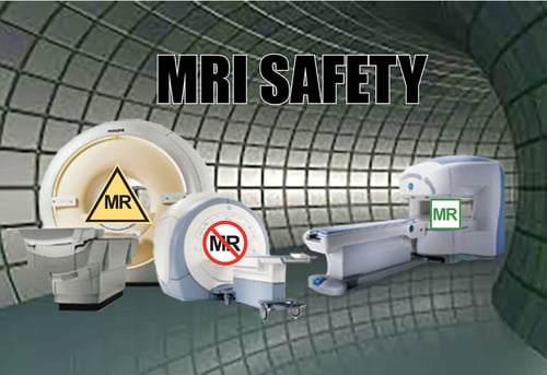 MRI Safety Concern