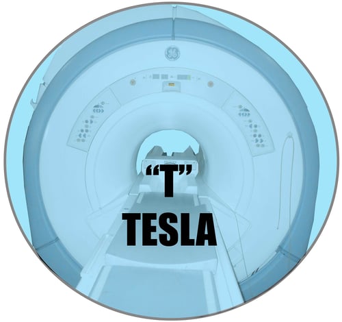 MRI Tesla