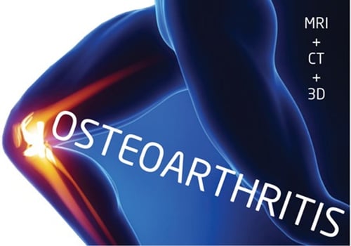 MRI-CT-3D-OstI-1