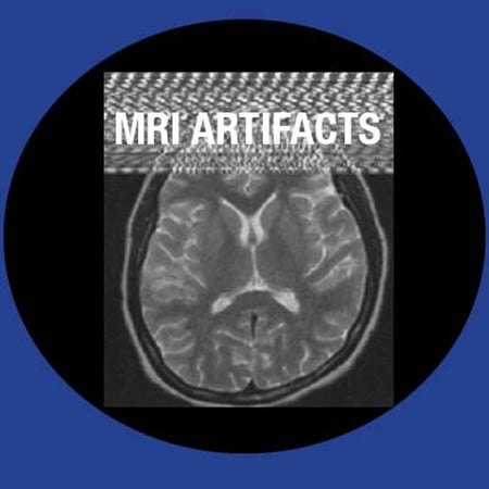 MRI_Artifacts-1