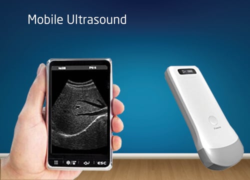Mobile Ultrasounds