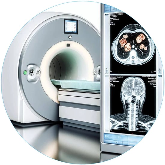 PET-CT Time of Flight