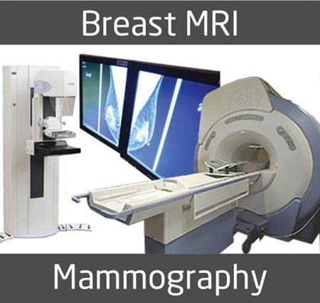 breastMRIorMammo-1