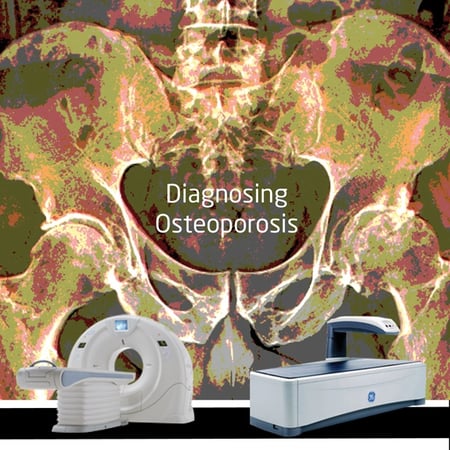 dxa cT Scanner