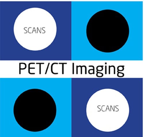 pet-ct1